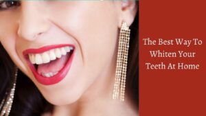 The Best Way To Whiten Your Teeth At Home - Beautiful Smile